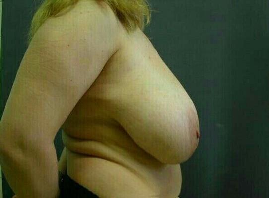 Meine hänge titten und mein Speck Bauch für euch