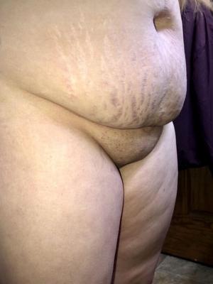 Chubby BBW femme poilue vergetures ventre