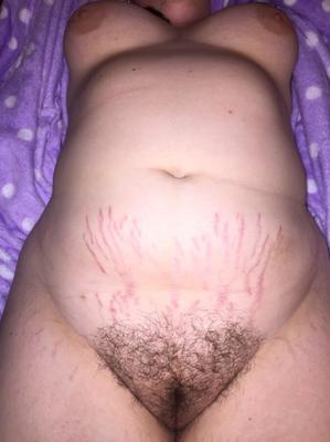 Eles têm estrias e querem sexo
