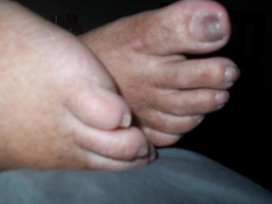 Pieds endormis