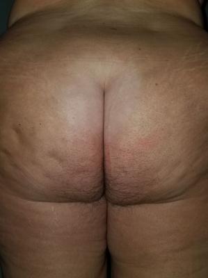 Saggy bbw bunda peluda e vista lateral