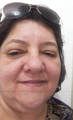 gozada na cara dela