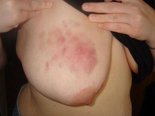 Mis maduras BBW Painsluts - Tetas torturadas, azotadas y magulladas