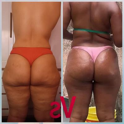 Roziela vs Kênia 