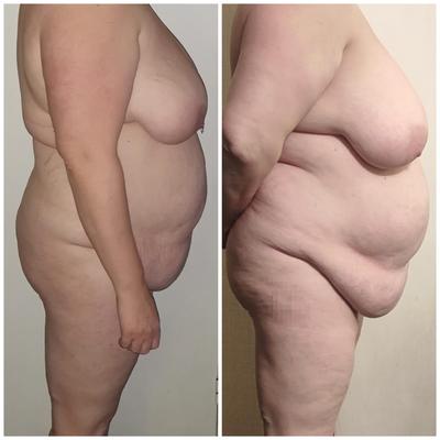 BBW妻格闘